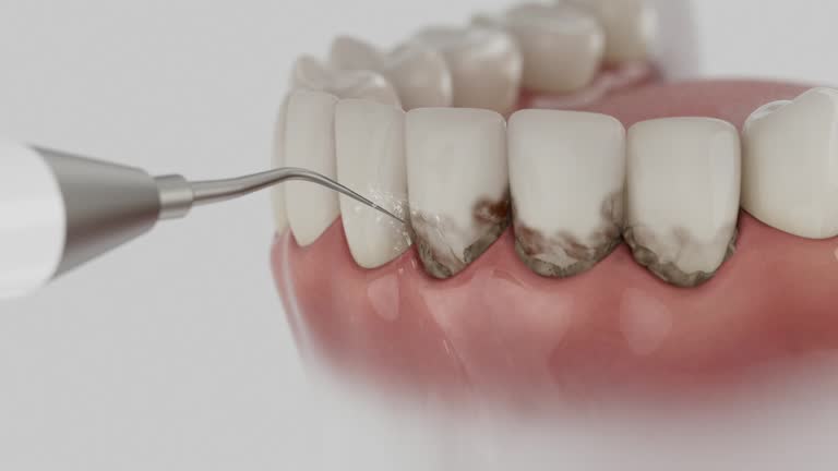 Reliable Dental contractor in Milwaukee, WI by Smile Center Dentistry